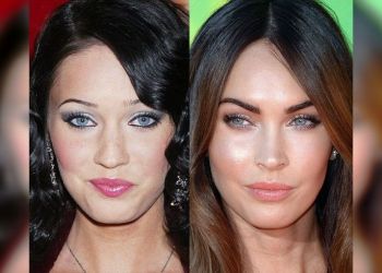 Страшно красивые: 40 фото знаменитостей до и после пластических операций