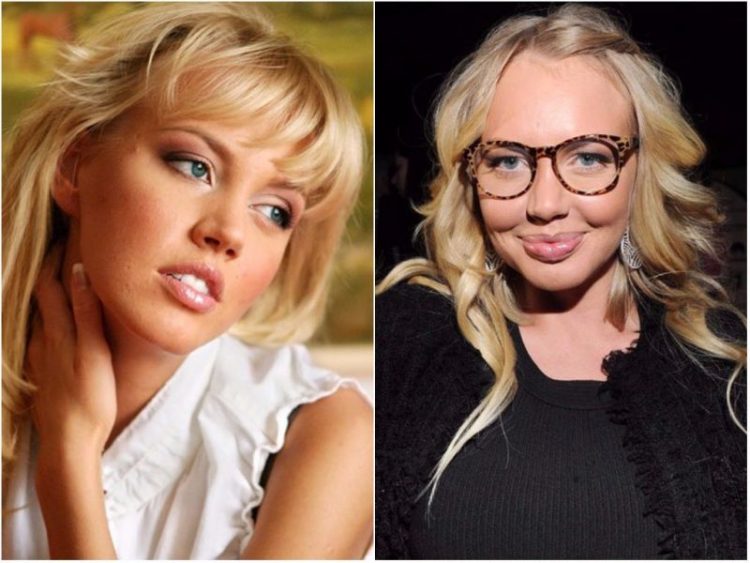 Страшно красивые: 40 фото знаменитостей до и после пластических операций
